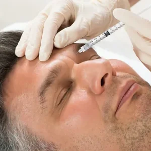 Dysport 180 Units or Botox | Xeomin 60 Units