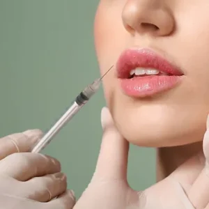Lip filler