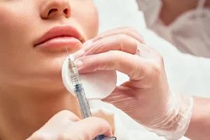 Restylane Filler - buy 2 syringes