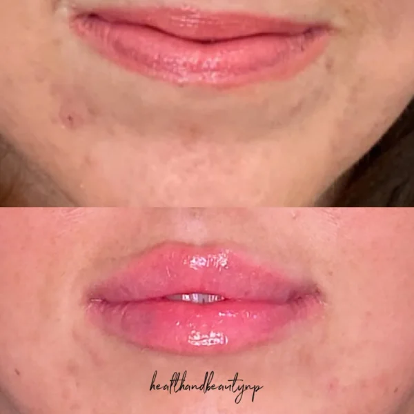 result-before-after-e-by-ARME-PLLC-in-Kingsport-TN