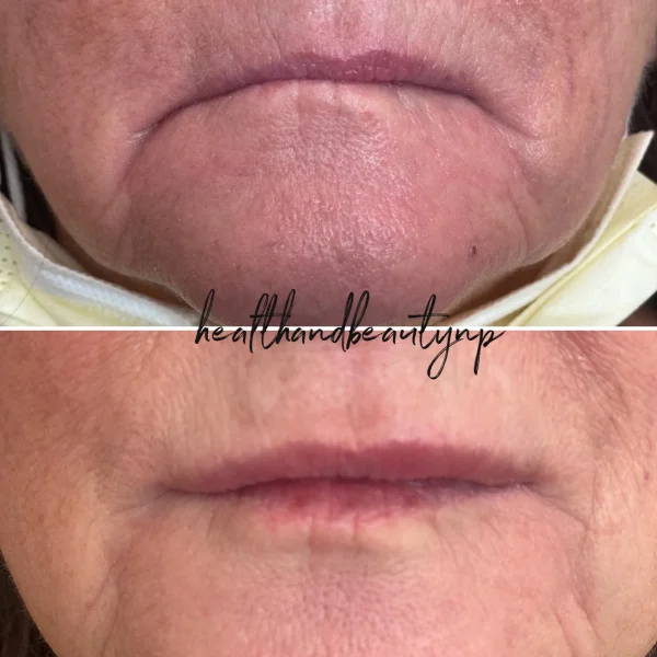 result-before-after-k-by-ARME-PLLC-in-Kingsport-TN