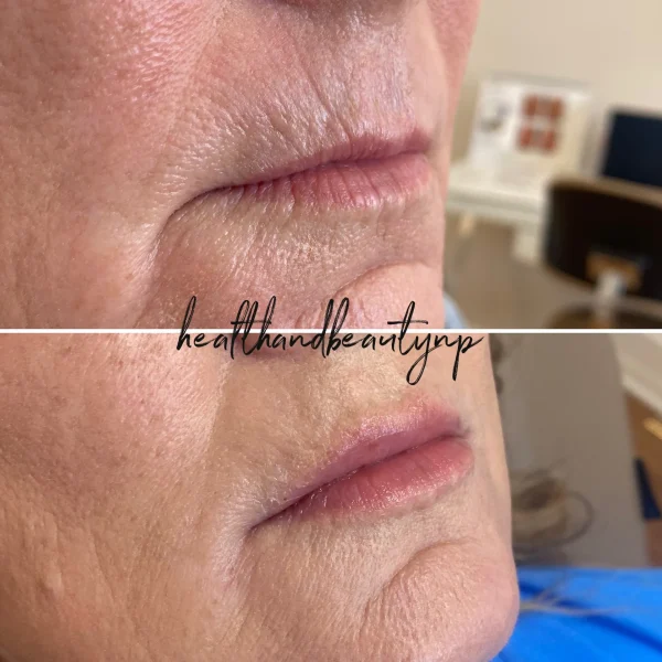 result-before-after-l-by-ARME-PLLC-in-Kingsport-TN