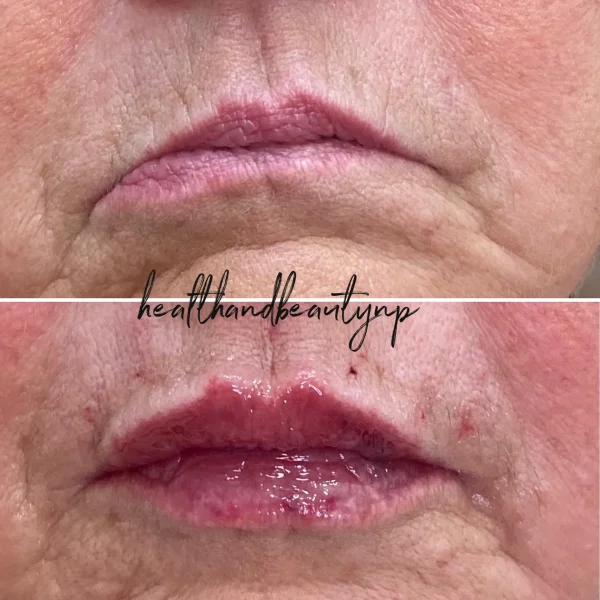 result-before-after-m-by-ARME-PLLC-in-Kingsport-TN