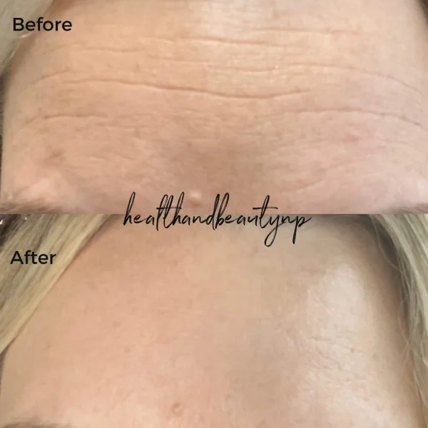 result-before-after-n-by-ARME-PLLC-in-Kingsport-TN