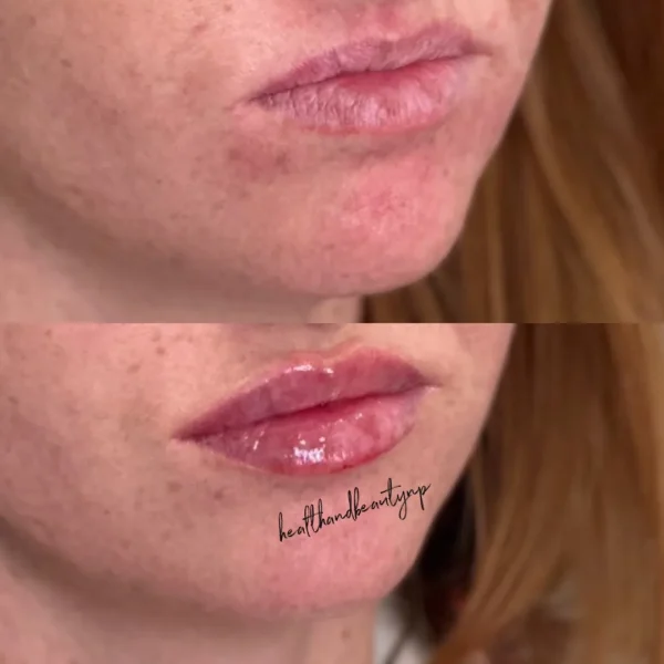 result-before-after-nn-by-ARME-PLLC-in-Kingsport-TN