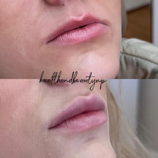 result-before-after-q-by-ARME-PLLC-in-Kingsport-TN