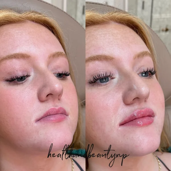 result-before-after-r-by-ARME-PLLC-in-Kingsport-TN