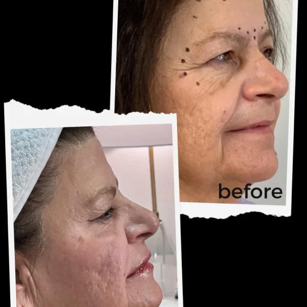 result-before-after-w-by-ARME-PLLC-in-Kingsport-TN