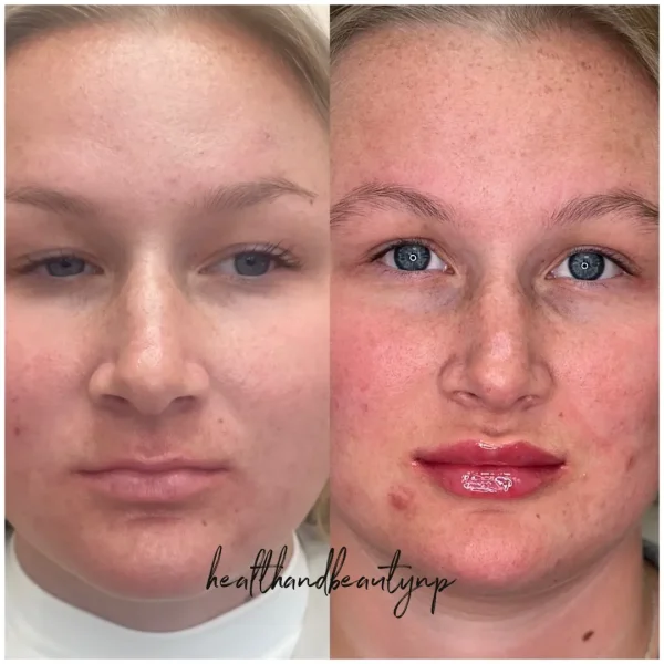 result-before-after-z-by-ARME-PLLC-in-Kingsport-TN