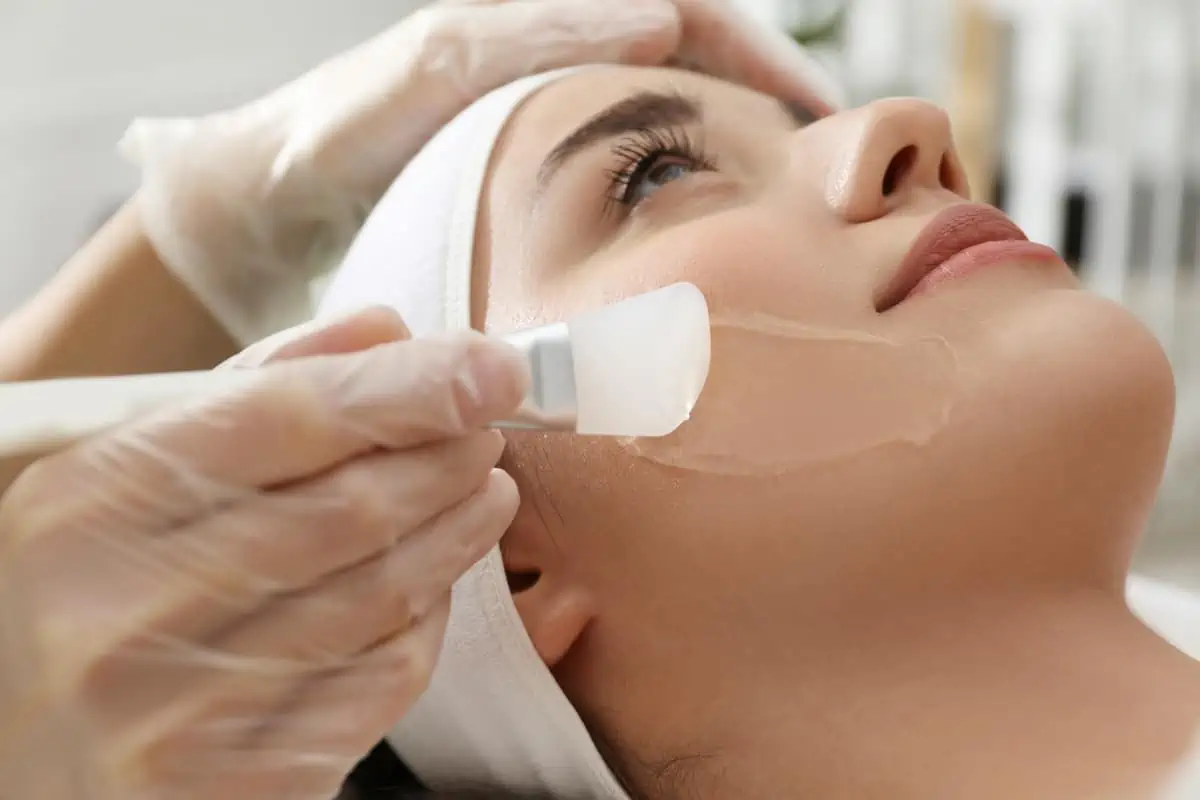 Chemical Peels by Armé Wellness in Kingsport TN