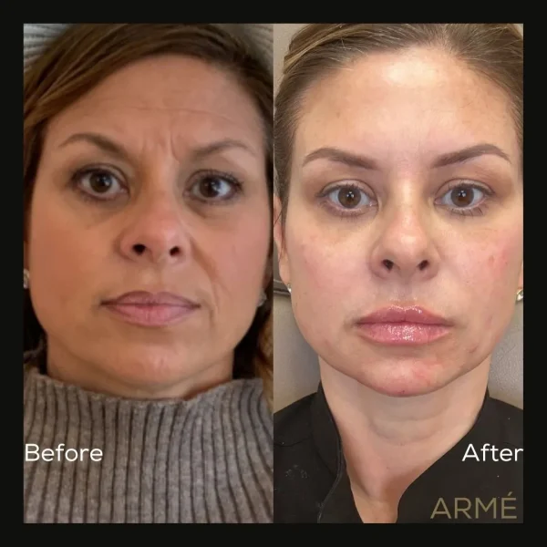 result-before-after-g-by-ARME-PLLC-in-Kingsport-TN
