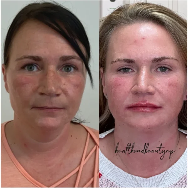 result-before-after-jj-by-ARME-PLLC-in-Kingsport-TN