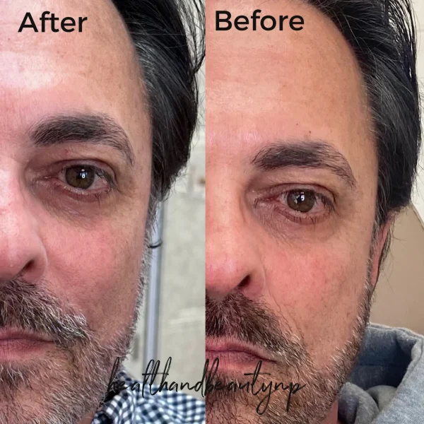 result-before-after-p-by-ARME-PLLC-in-Kingsport-TN